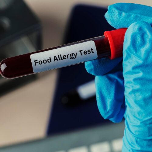 food allergy test at home